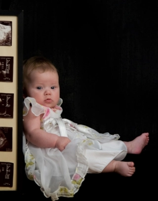 APOLONIA APOLONIA zdjęcie 3